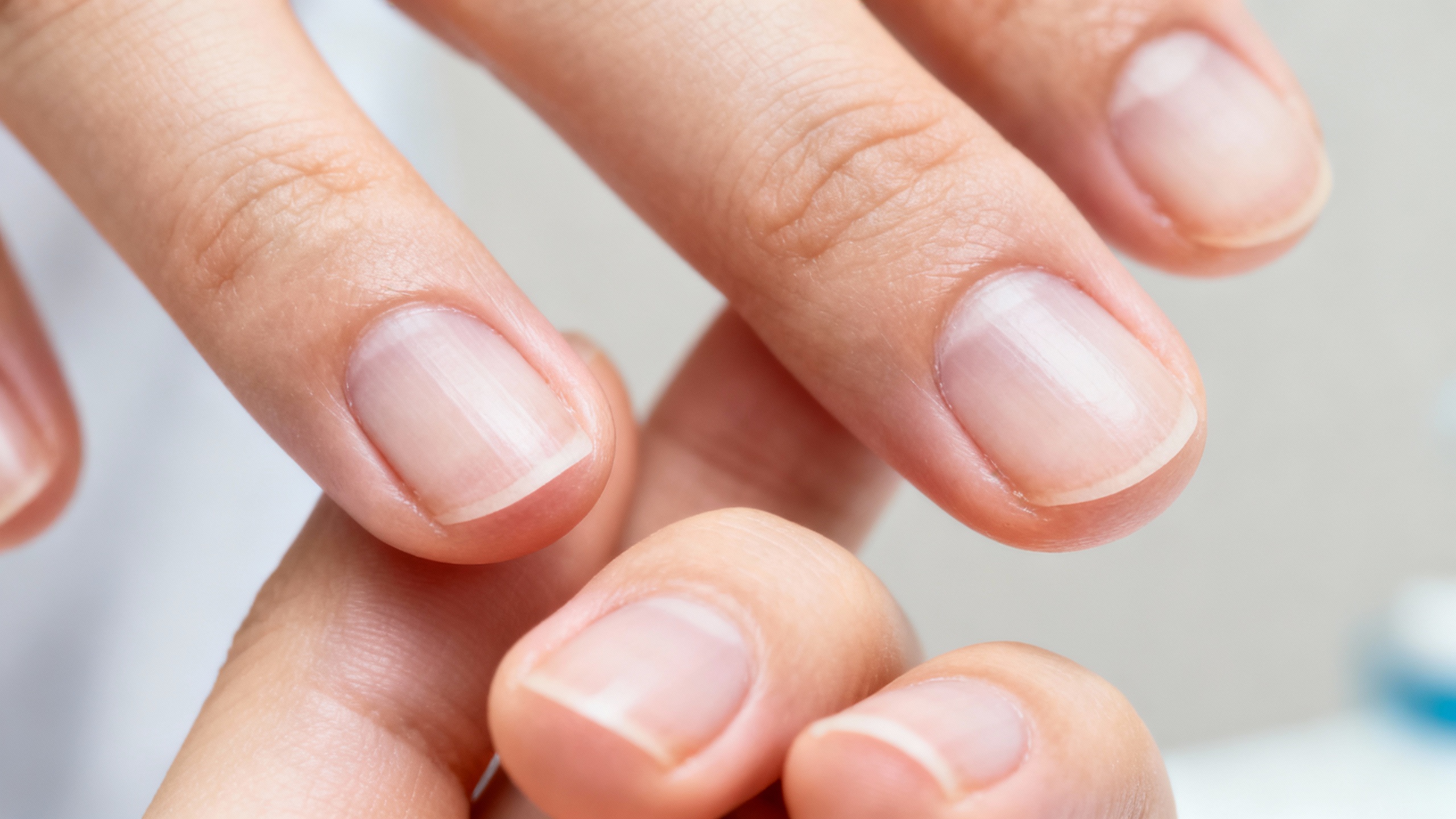 Featured image for Ultimate Guide: Understanding and Recognizing Nail Fungus Symptoms